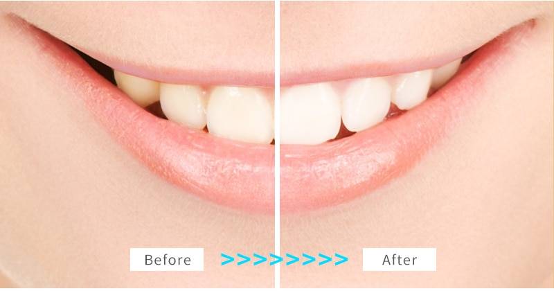 Seago Sonic Electric Toothbrush Tooth brush USB Rechargeable adult Waterproof Ultrasonic automatic 5 Mode with Travel case Seago Sonic Electric Toothbrush Tooth brush USB Rechargeable adult Waterproof Ultrasonic automatic 5 Mode with Travel case