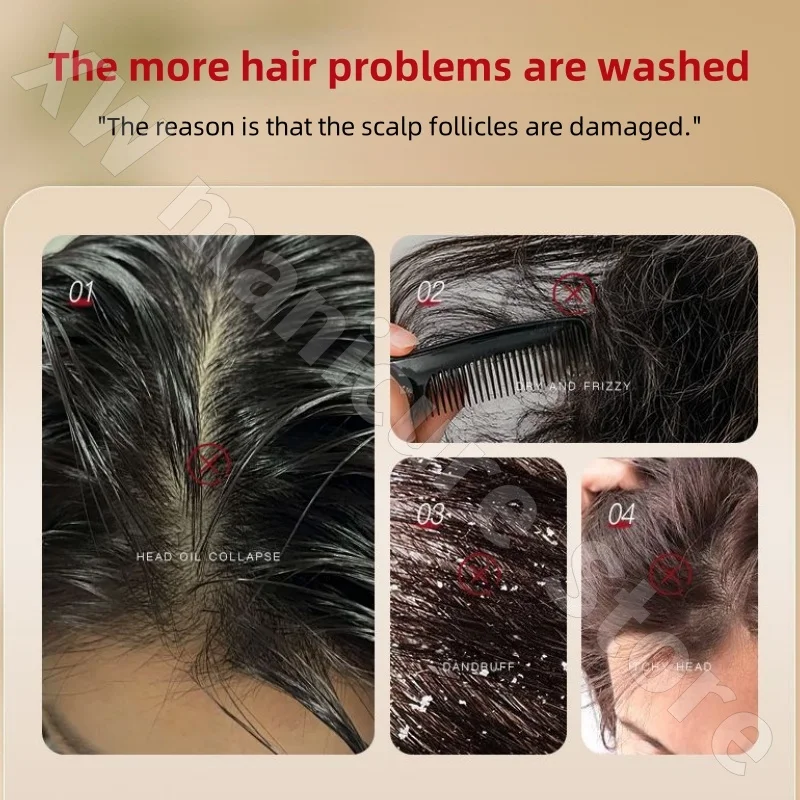 Seven-green Usman Orchidaceae Shampoo – شامبو أوسمان من فصيلة الأوركيد LESS 10 KD Seven-green Usman Orchidaceae Shampoo Refreshing Cleansing Oil Control Anti-Itch Replenishing Soap Soft Handmade Soap 120g LESS 10 KD Smart Techs, Better Living